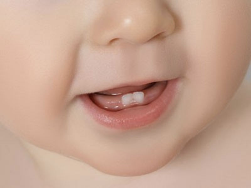Sollievo delle gengive infiammate durante la dentizione con sonaglio in legno naturale sicuro